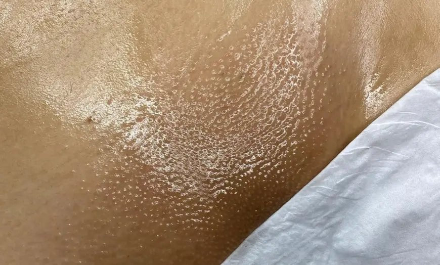 What Is a Brazilian Wax? Everything You Need to Know - Enhanced Estetic